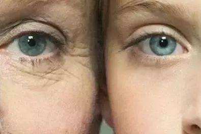 肌肤粗糙如何改善