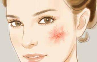 角质层变薄还能恢复吗？角质层变薄怎么恢复？