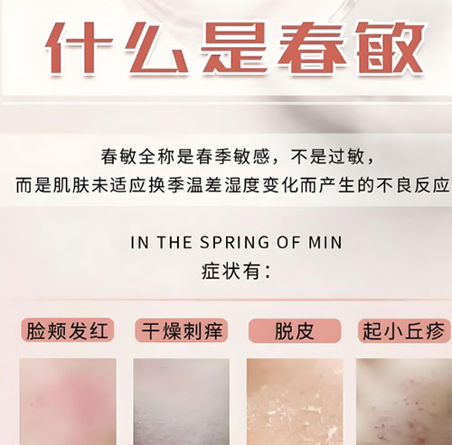 春敏是什么？如何有效预防春敏？